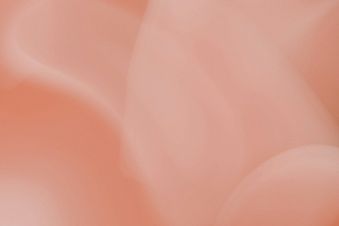 პოსტის ფოტო